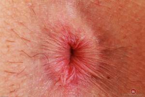 Original 3000 px/ 2000 px