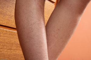 Original 3000 px/ 2000 px