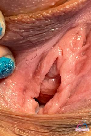 Original 2000 px/ 3000 px