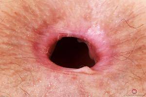 Original 3000 px/ 2000 px