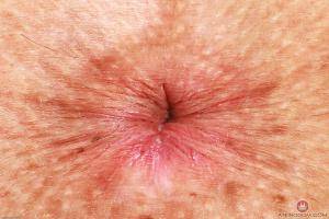 Original 3000 px/ 2000 px