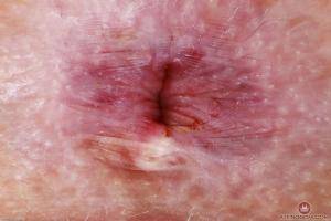 Original 3000 px/ 2000 px