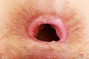 Original 3000 px/ 2000 px