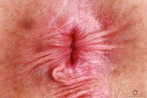 Original 3000 px/ 2000 px