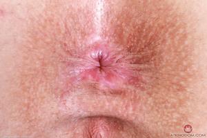 Original 5000 px/ 3333 px