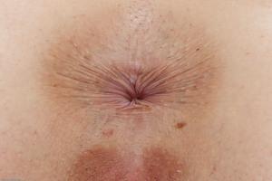 Original 3000 px/ 1999 px