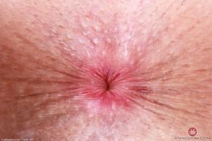 Original 5000 px/ 3333 px