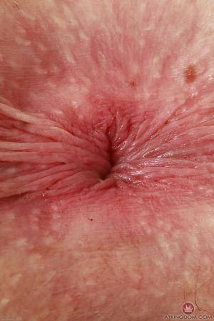 Original 2000 px/ 3000 px