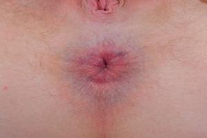 Original 3000 px/ 2000 px