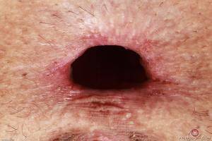 Original 3000 px/ 2000 px