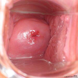 Original 1400 px/ 1400 px