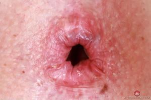 Original 5000 px/ 3333 px