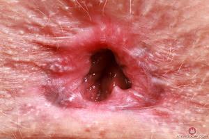 Original 3000 px/ 2000 px