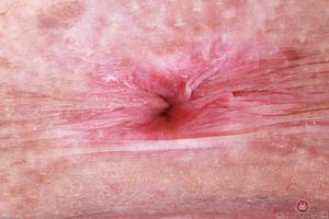 Original 3000 px/ 2000 px