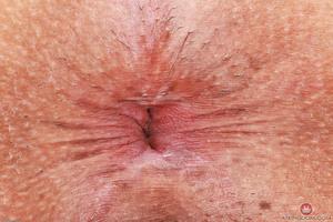 Original 3000 px/ 2000 px