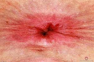 Original 3000 px/ 2000 px