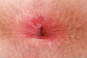 Original 3000 px/ 2000 px