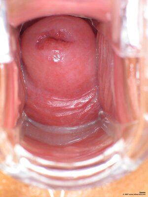 Original 1500 px/ 2000 px