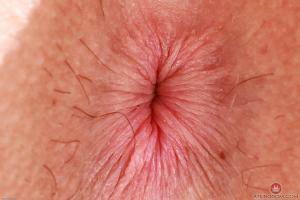 Original 3000 px/ 2000 px