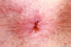 Original 3000 px/ 2000 px