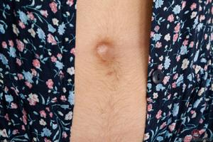 Original 3000 px/ 2000 px