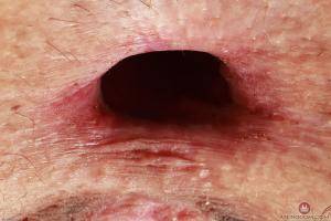 Original 3000 px/ 2000 px