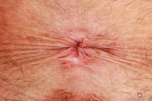 Original 3000 px/ 2000 px