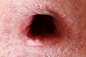 Original 3000 px/ 2000 px