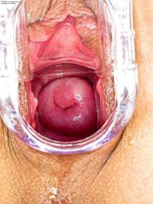 Original 1800 px/ 2400 px