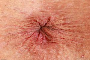 Original 3000 px/ 2000 px