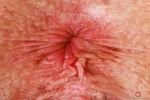 Original 3000 px/ 2000 px