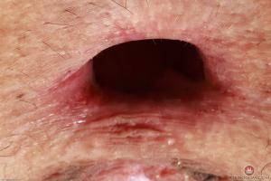 Original 3000 px/ 2000 px