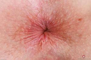 Original 3000 px/ 2000 px