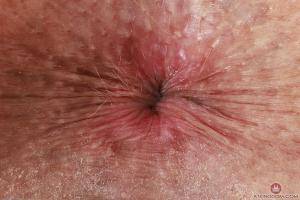 Original 3000 px/ 2000 px