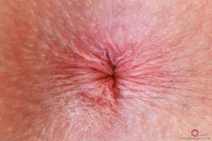 Original 3000 px/ 2000 px