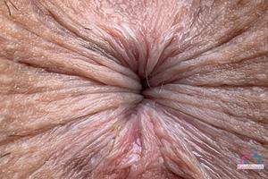 Original 3000 px/ 2000 px