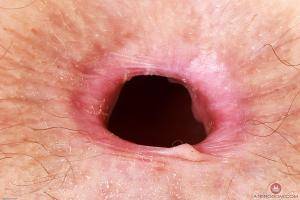 Original 3000 px/ 2000 px