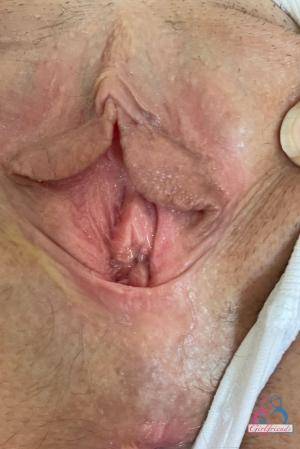 Original 854 px/ 1280 px