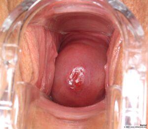 Original 1500 px/ 1300 px