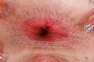 Original 3000 px/ 2000 px