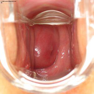 Original 1400 px/ 1400 px