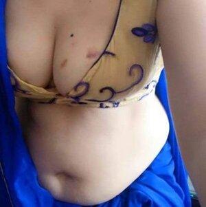 Original 399 px/ 400 px