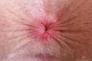 Original 5000 px/ 3333 px