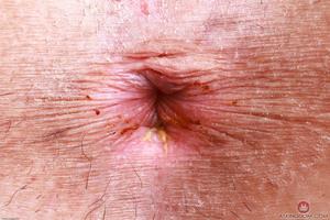 Original 3000 px/ 2000 px