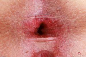 Original 3000 px/ 2000 px