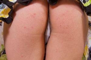 Original 1280 px/ 854 px