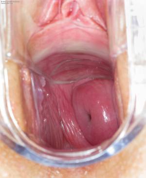 Original 1800 px/ 2200 px