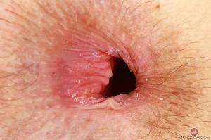 Original 3000 px/ 1999 px