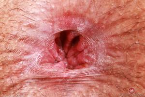 Original 5000 px/ 3333 px