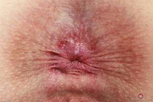 Original 3000 px/ 2000 px